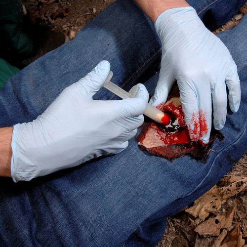 Аппликатор гемостатический с гранулами Rhino Rescue в Смоленске хитозановый